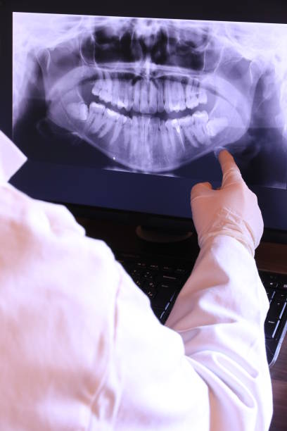 Best Emergency Dental Care for Broken or Chipped Teeth in Barrington, IL